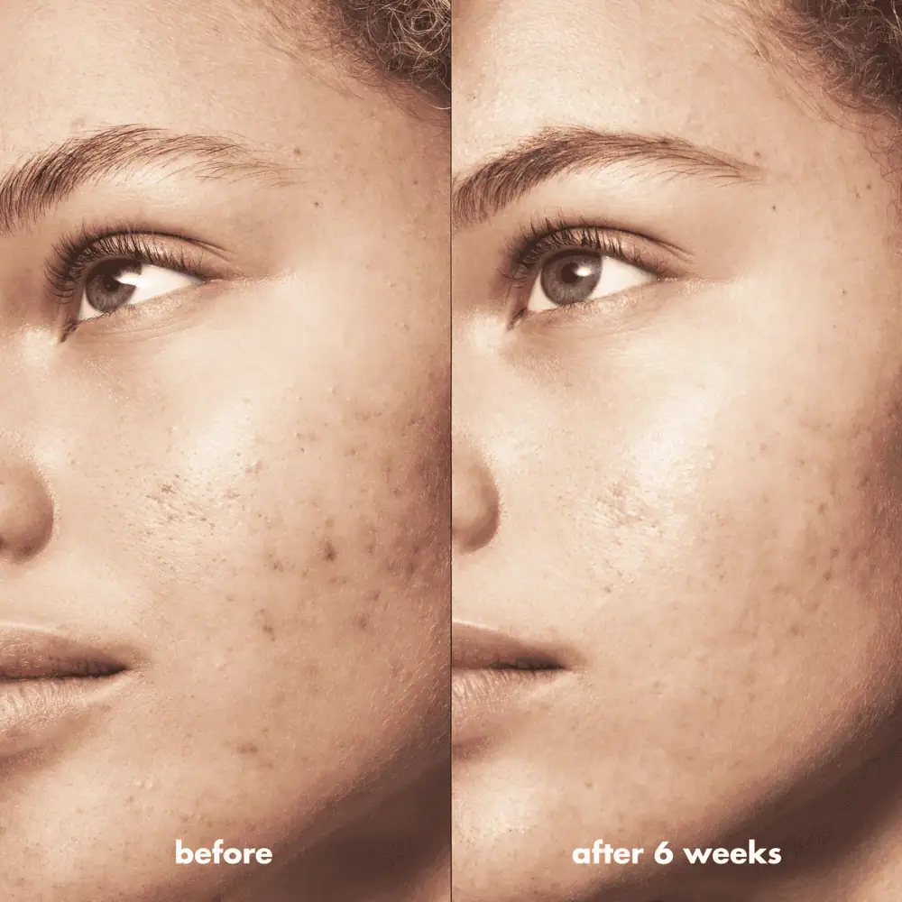 E.L.F Blemish Breakthrough Acne Calming Water Cream - Lebanon - Makeup Germany E.L.F Blemish Breakthrough Acne Calming Water Cream e.l.f Acne Water Cream for sale in Lebanon - lightweight gel cream