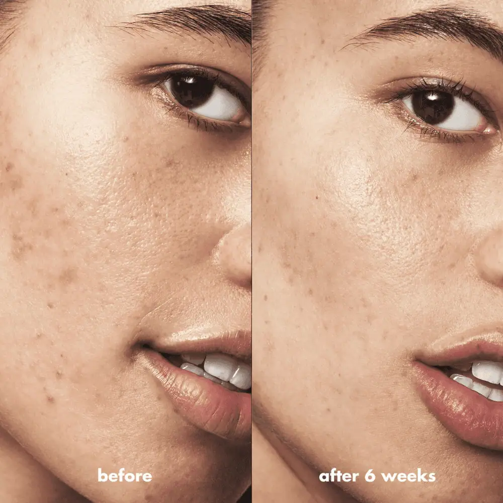 E.L.F Blemish Breakthrough Acne Calming Water Cream - Lebanon - Makeup Germany E.L.F Blemish Breakthrough Acne Calming Water Cream e.l.f Acne Water Cream for sale in Lebanon - lightweight gel cream